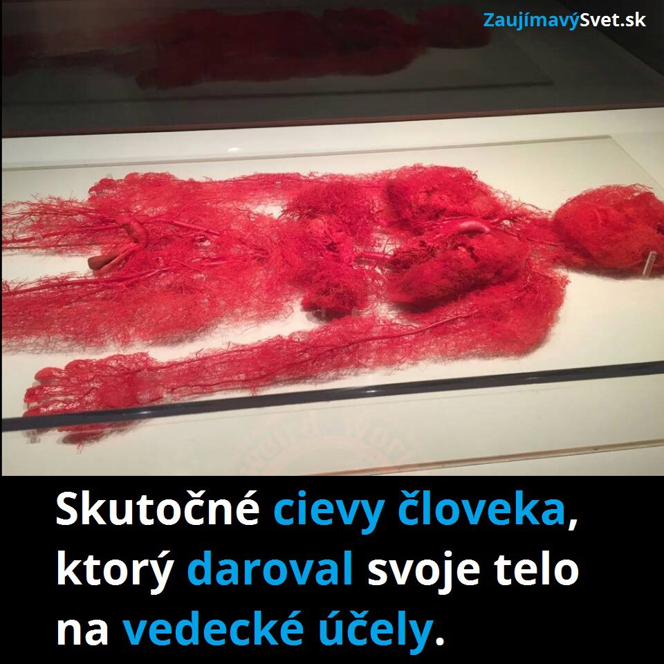 Takto vyzerá skutočný cievny systém človeka