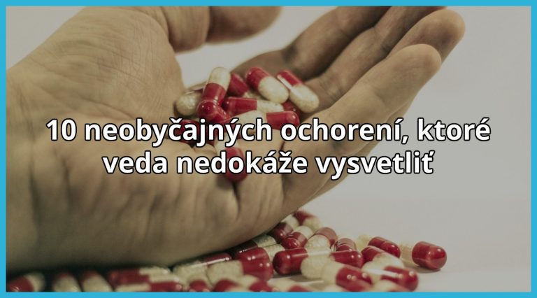 10 neobyčajných ochorení, ktoré veda nedokáže vysvetliť