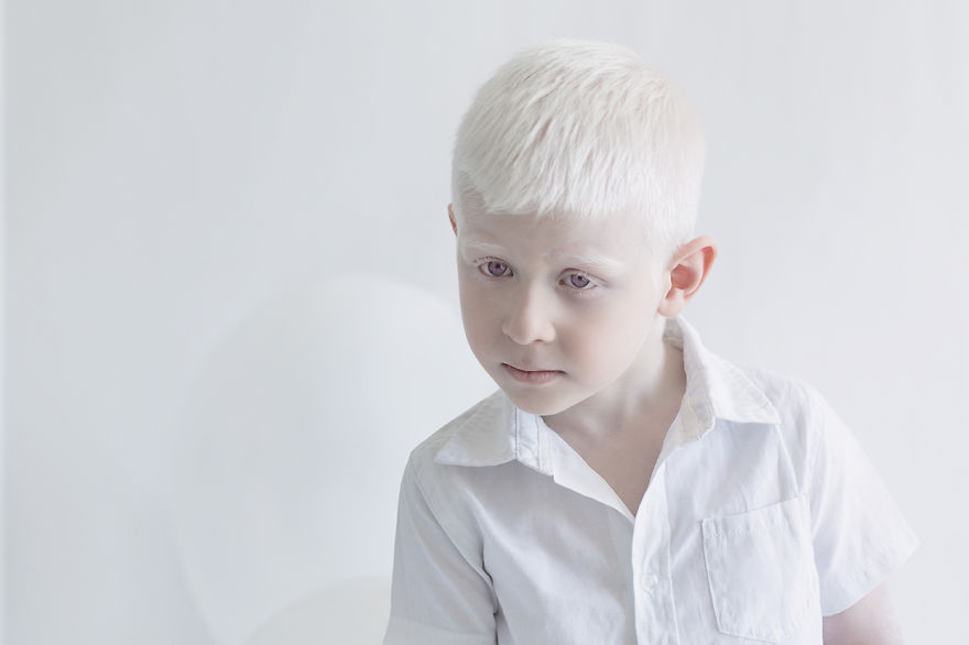 albino10
