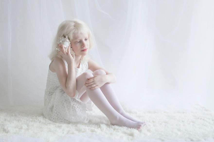 albino11