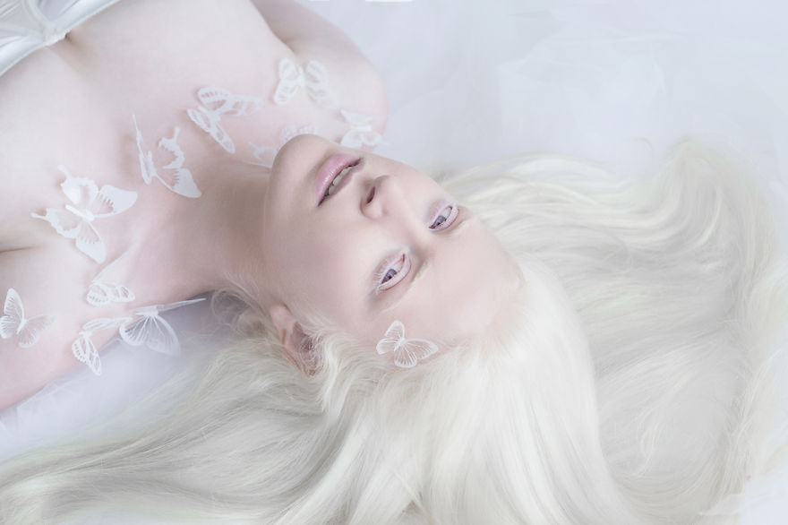 albino2