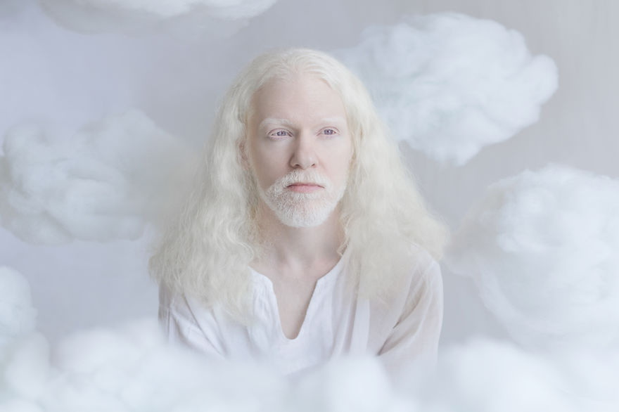 albino4