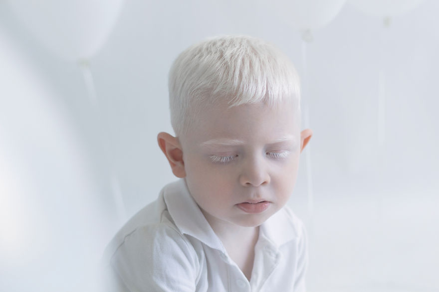 albino6