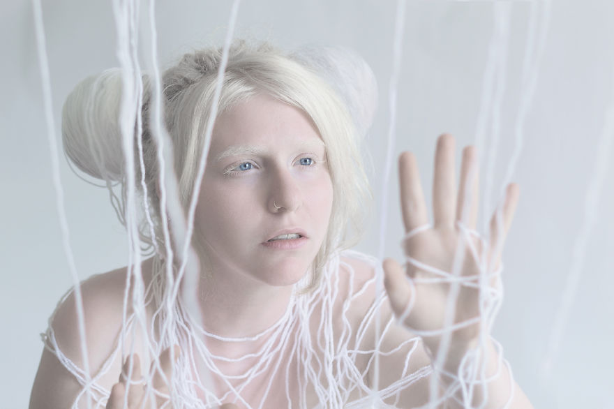 albino7