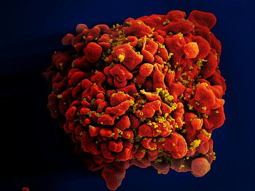 HIV fotografia