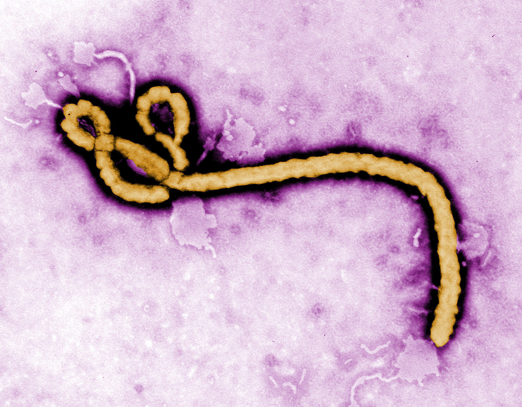 ebola fotografia