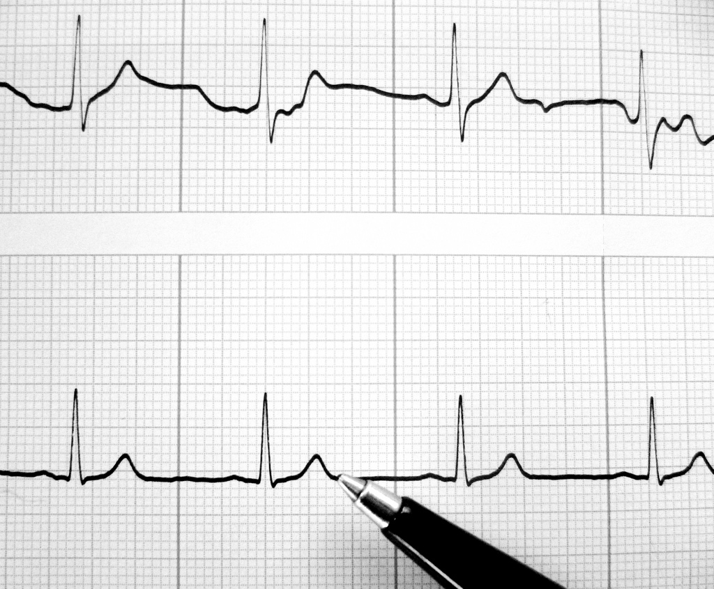 ECG fotografia