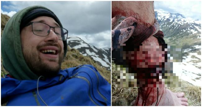 Mladý muž prežil útok rozzúrenej medvedice vďaka tomu, že ju udrel do tváre