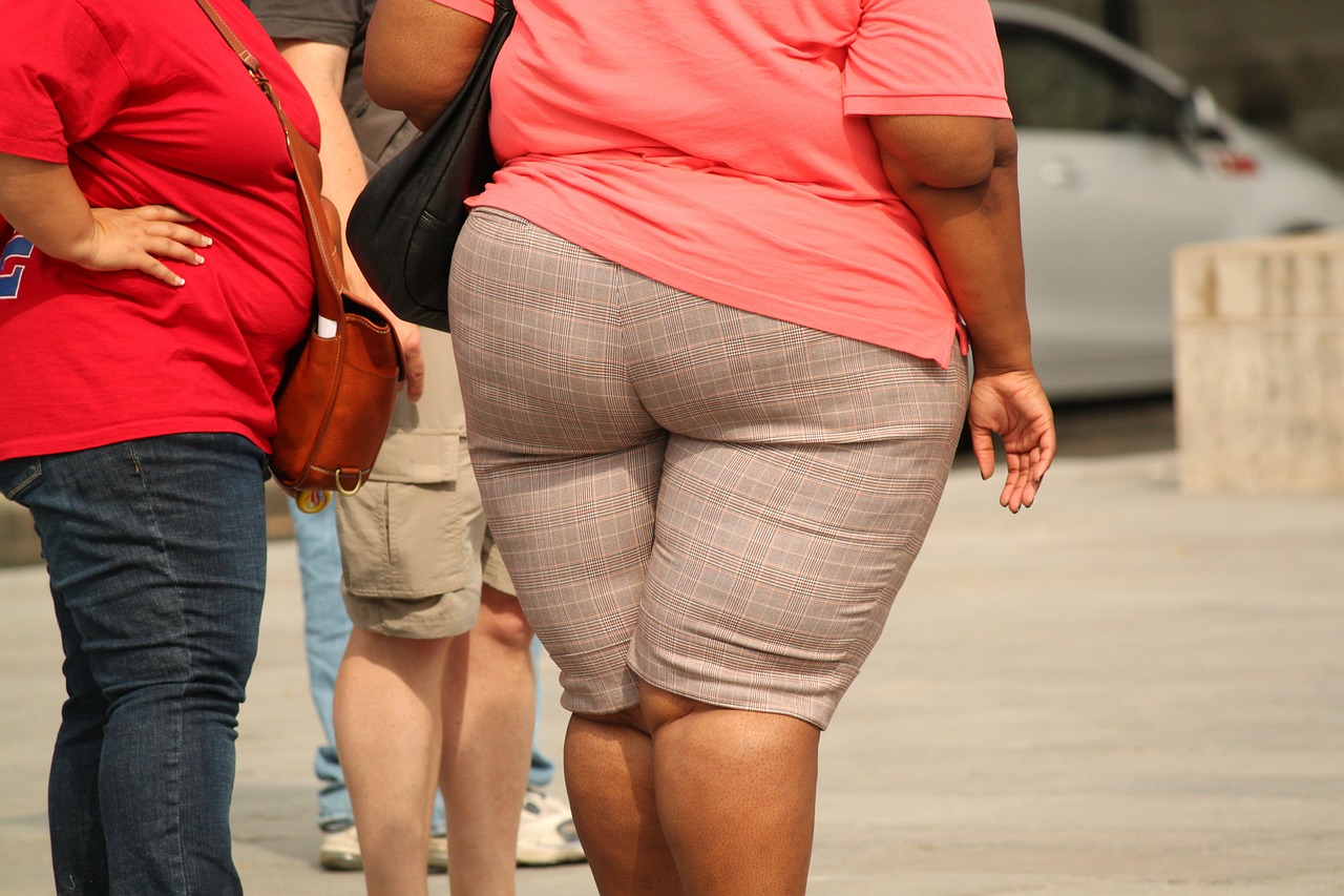 obesity fotografia