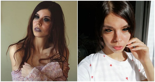 Poľská modelka si dala potetovať očné buľvy. Na jedno oko nevidí a aj druhé pomalý stráca zrak