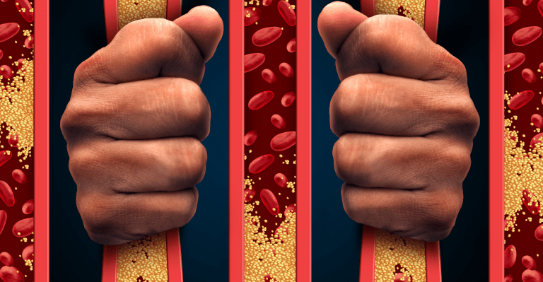 Vysoký cholesterol trápi čoraz viac ľudí – Ako ho znížiť aj bez liekov pomocou potravín či pohybom?