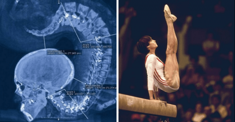 13 olympionikov a iných atlétov, ktoré vám ponúknu nový pohľad na ľudské telo