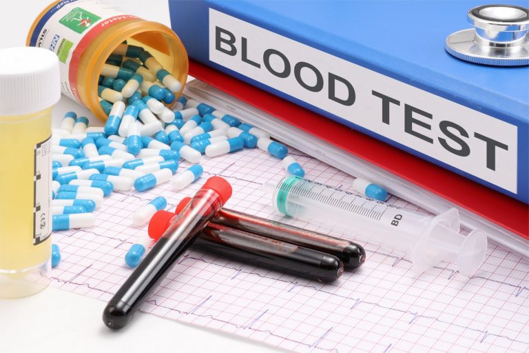 Jednoduchý krvný test dokáže odhaliť až 50 druhov rakoviny!
