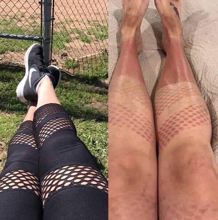 things gone wrong tan lines from leggings