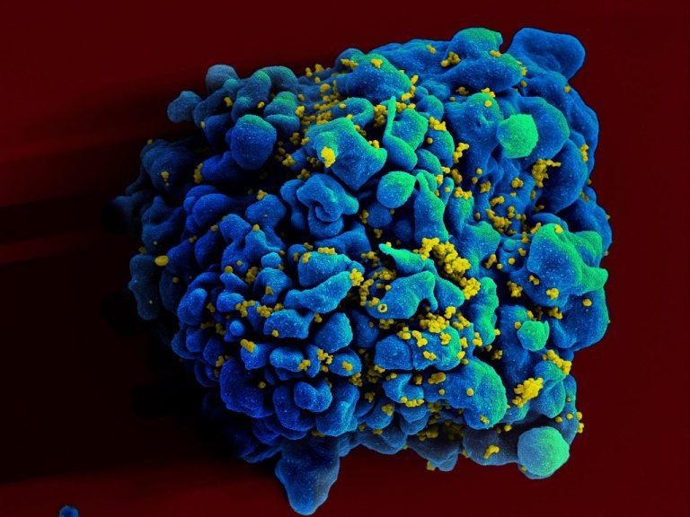 Americkému výskumnému tímu sa pravdepodobne prvýkrát podarilo vyliečiť ženu z HIV. Vedci využili novú metódu transplantácie kmeňových buniek