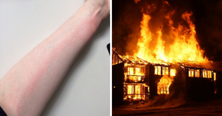12 užitočných rád, ktoré vám môžu jedného dňa zachrániť život