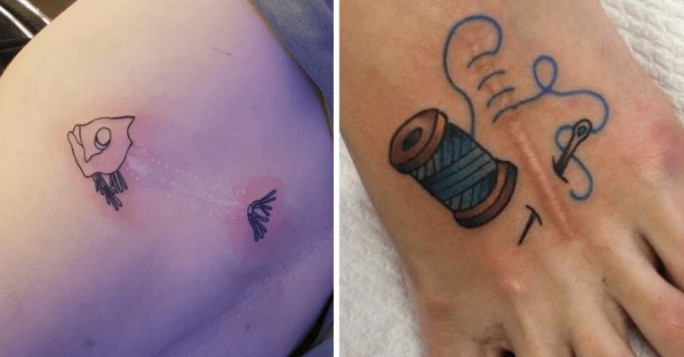 13 tetovaní, ktorými si ľudia zakryli svoje jazvy