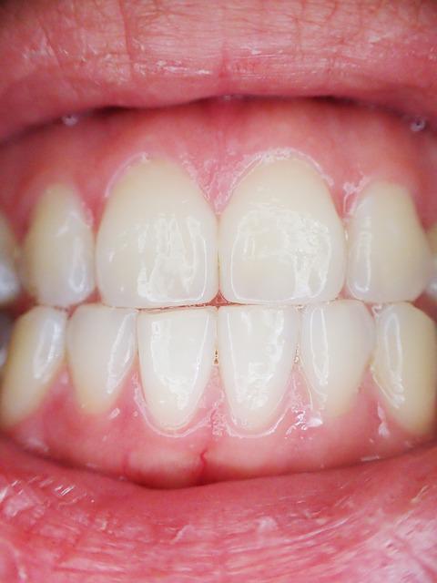 Photo by endlesswatts tooth photo