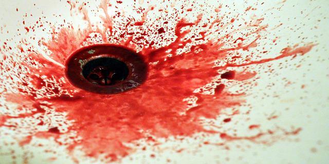 Photo by Kawamaru bleeding out photo