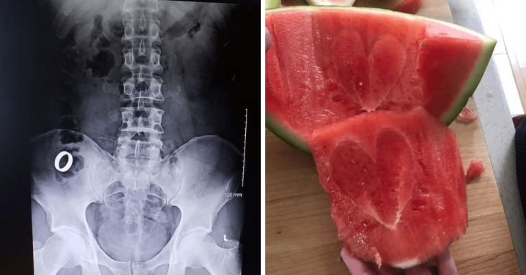 12 ľudí, z ktorých si vesmír urobil žart a stali sa im tieto veci
