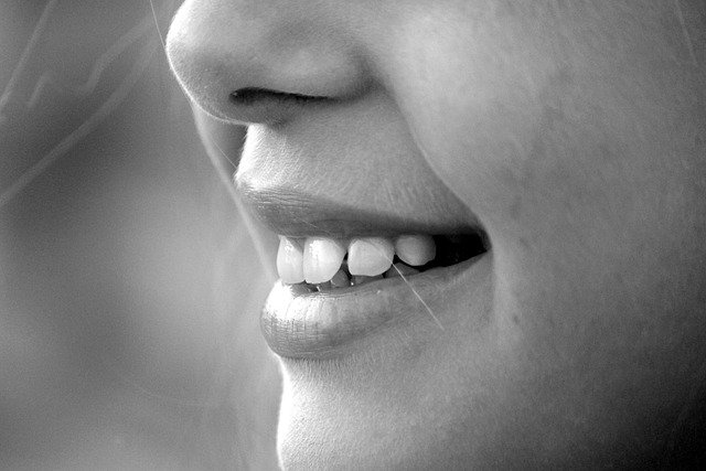 Photo by Giuliamar teeth photo