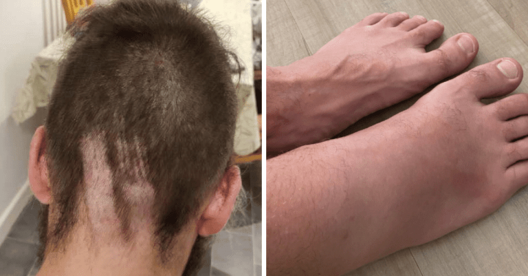 12 ľudí, ktorí mali taký zlý deň, že si želajú, aby mal tlačidlo na resetovanie