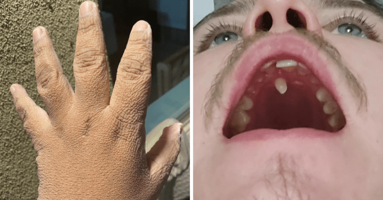 13 zaujímavých fotografií, ktoré zobrazujú jedinečnosť ľudí
