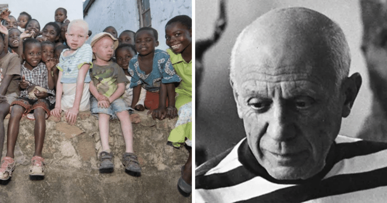 Zaujímavosti ku káve, ktoré ti zaručene rozšíria obzory #1496 – albínske deti v štáte Malawi sú lovené kvôli kostiam, ktoré podľa povery prinášajú domorodým obyvateľom šťastie a Pablo Picasso nosil nabitý revolver, ktorým strieľal na ľudí, čo nechápali významy jeho obrazov