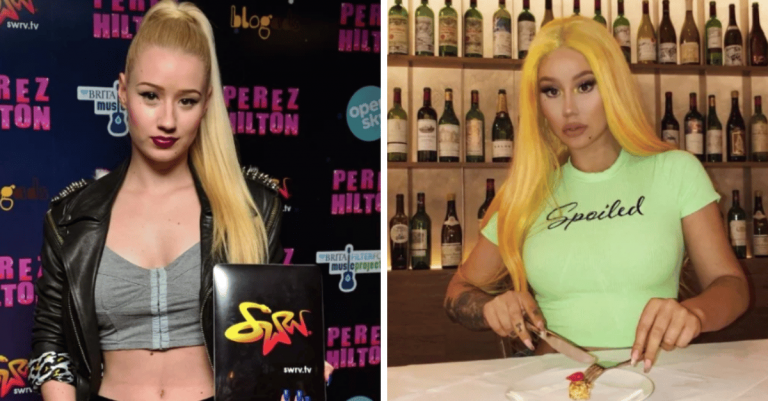 Celebrity pred a po plastickej operácii: Ako veľmi sa zmenili?