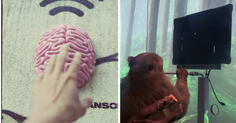 Elon Musk a Neuralink: Od učenia až po vyliečenie chorôb. Ako by mohol čip v mozgu zlepšiť naše životy?