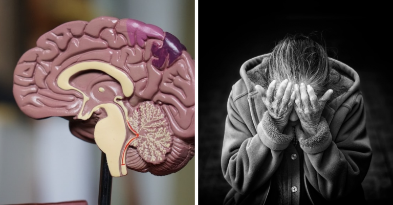 Čo ste si možno mysleli o Alzheimerovej chorobe, ale nie je to pravda