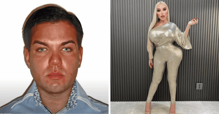 Minula milión dolárov, aby zo seba spravila Barbie. Pozrite sa, ako dnes vyzerá