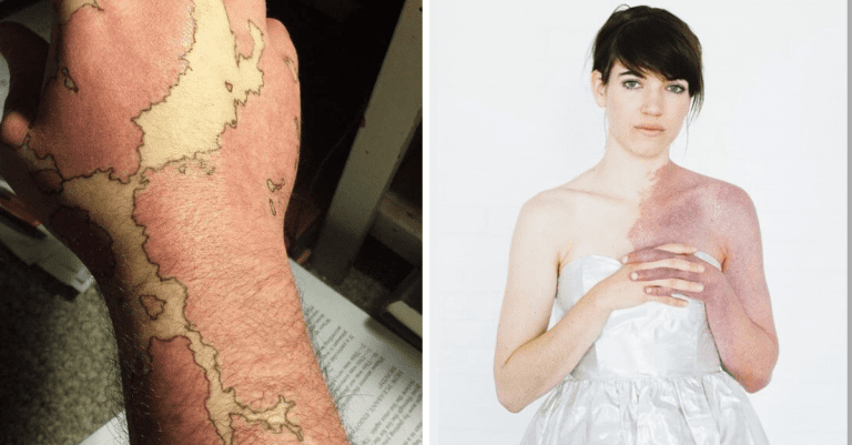Vzácne a krásne materské znamienka, ktoré musíte vidieť, aby ste uverili