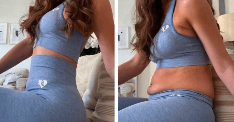 Instagram vs. realita – pozrite sa, ako rozdielne môže vyzerať na fotografiách to isté telo