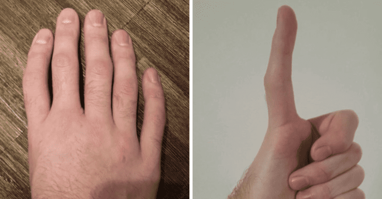 Pozrite si fotografie 11 ľudí, ktorí sa neboja ukázať svoju jedinečnosť