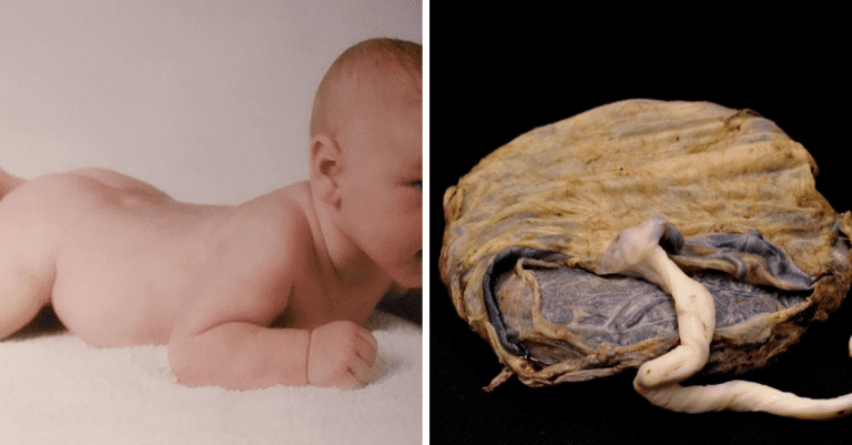 Sú to najmä ženy, ktoré sú pre krásu ochotné obetovať veľa. Dokonca toho aj veľa vyskúšať. Napríklad krém z ľudskej predkožky, aké sú ďalšie bizarné výmysly? Čítajte. 