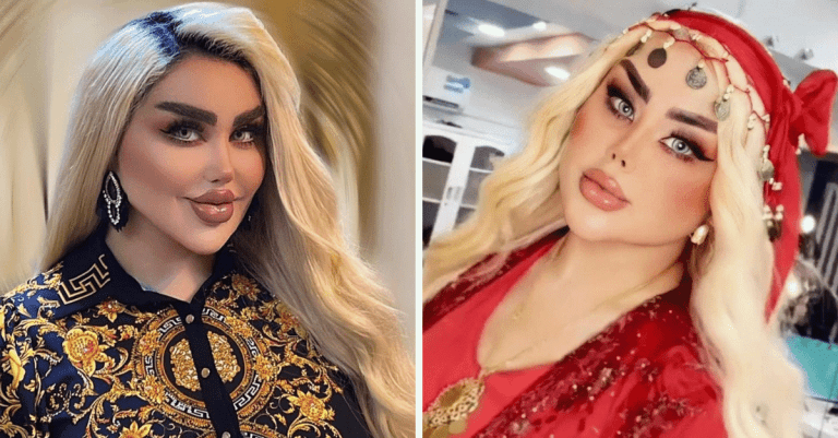 Chcela vyzerať ako Barbie, no ľudia ju volajú zombie: Pozrite sa, ako dnes vyzerá