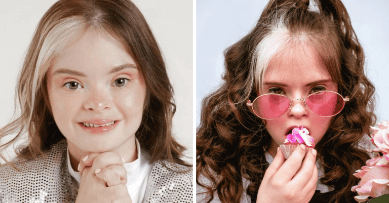 Modelka s Downovým syndrómom inšpiruje ostatných a redefinuje štandardy krásy