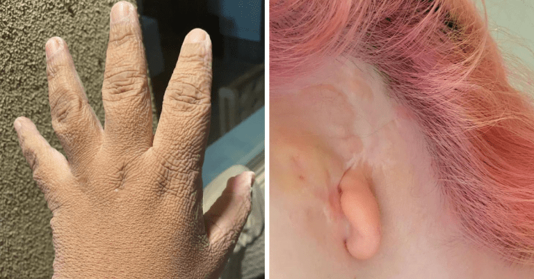9 jedinečných fyzických vlastností, s ktorými sa narodili niektorí ľudia