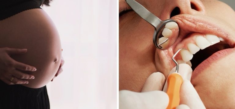 Čo všetko dokáže dentista zistiť zo stavu vašej ústnej dutiny? Budete prekvapení.