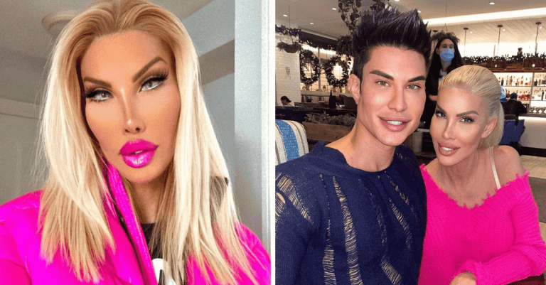 Transrodová žena zaplatila milión dolárov, aby sa podobala na Barbie. Ako dnes vyzerá?
