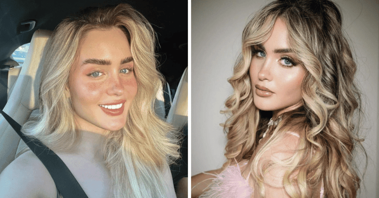 Influencerka minula na kozmetické zákroky desiatky tisíc dolárov, pretože nemala rada samú seba
