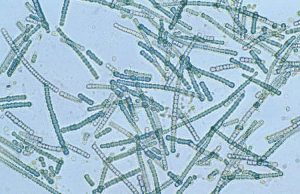 cyanobacteria photo u2