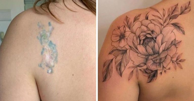 Ľudia premenili svoje jazvy na umelecké diela. Pozrite sa na ukážky tetovaní, ktoré sa o to postarali