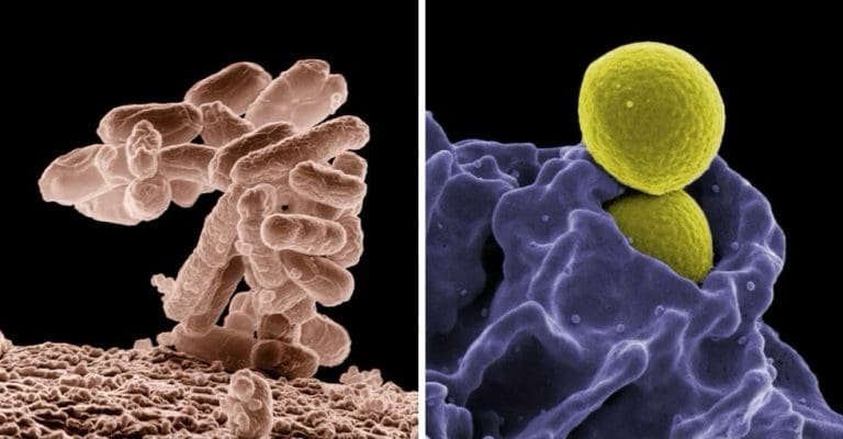 Pôvodcovia ochorení, ktorí sú odolní voči antibiotikám – predstavujú vážnu hrozbu a nebezpečenstvo.