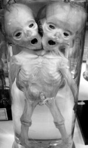 deformed fetuses and other oddities were displayed in jars photo u2