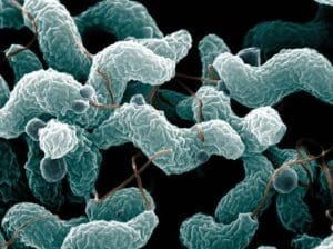 drug resistant campylobacter photo u1