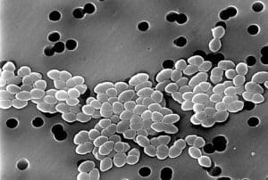 vancomycin resistant enterococcus photo u1