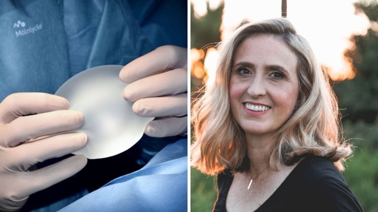 Kedy sa začalo s estetickými zákrokmi, odkiaľ pochádzala prvá žena s prsnými implantátmi – čítajte a dozviete sa oveľa viac.