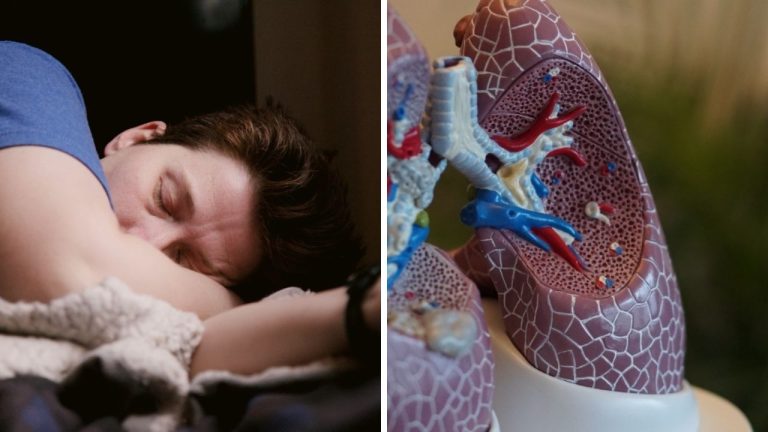 9 príznakov ochorenia obličiek, ktoré netreba podceniť